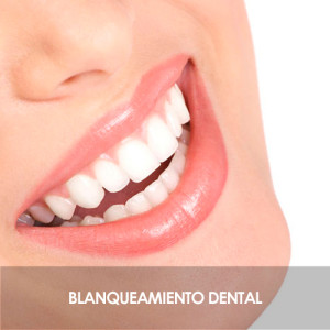 Tratamiento DUO Tratamiento DUO. Blanqueamiento Dental.