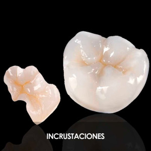 Tratamiento DUO Tratamiento DUO. Incrustaciones.