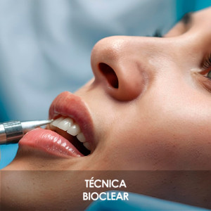 La técnica Bioclear es una opción innovadora para mejorar la estética dental, especialmente cuando se trata de reparar dientes dañados o desgastados La técnica Bioclear es una opción innovadora para mejorar la estética dental, especialmente cuando se trata de reparar dientes dañados o desgastados.